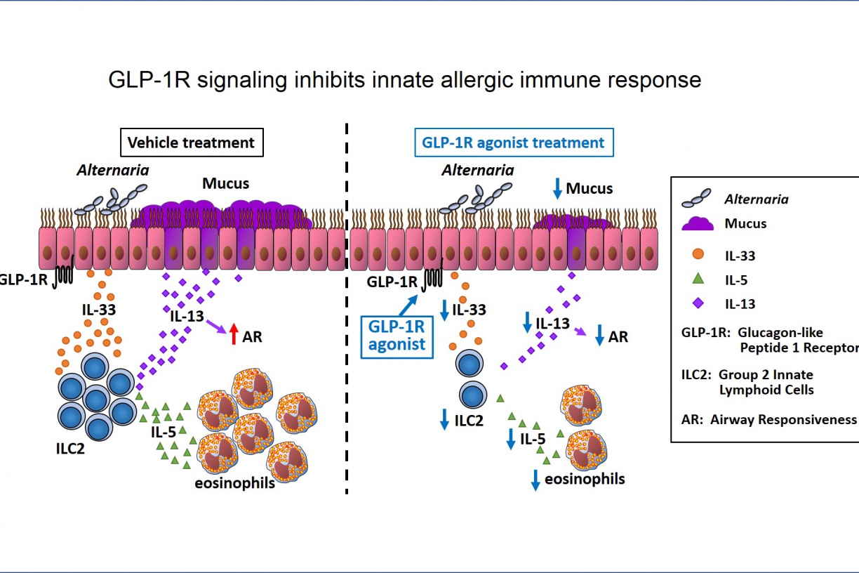 GLP-1R signaling inhibits innate allergic immune response