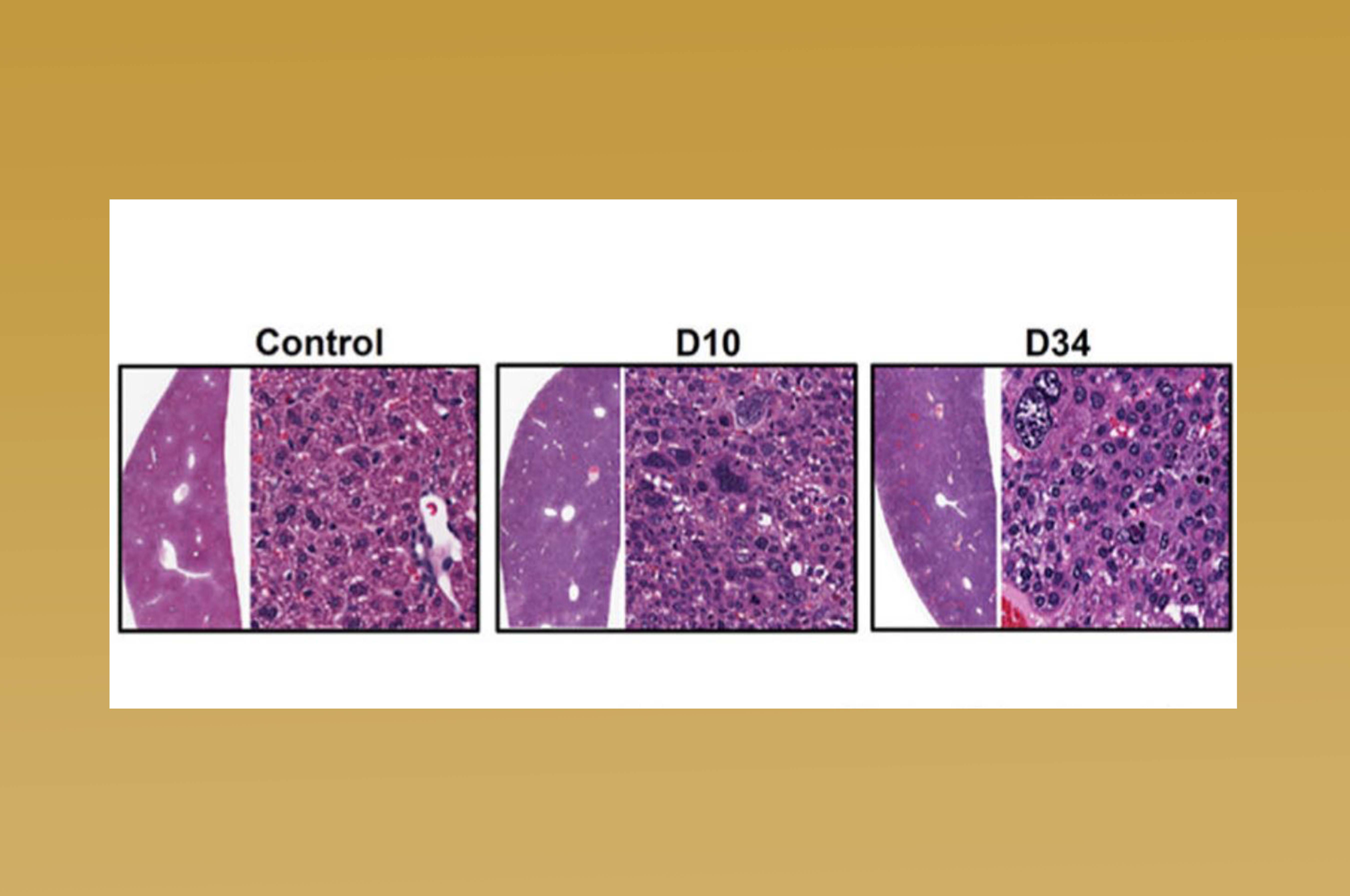 Liver carcinogenesis in ASTxCre-ERT2 mice. Hematoxylin and eosin (H&E) staining of liver sections collected at D10, and D34 after Tam treatment.