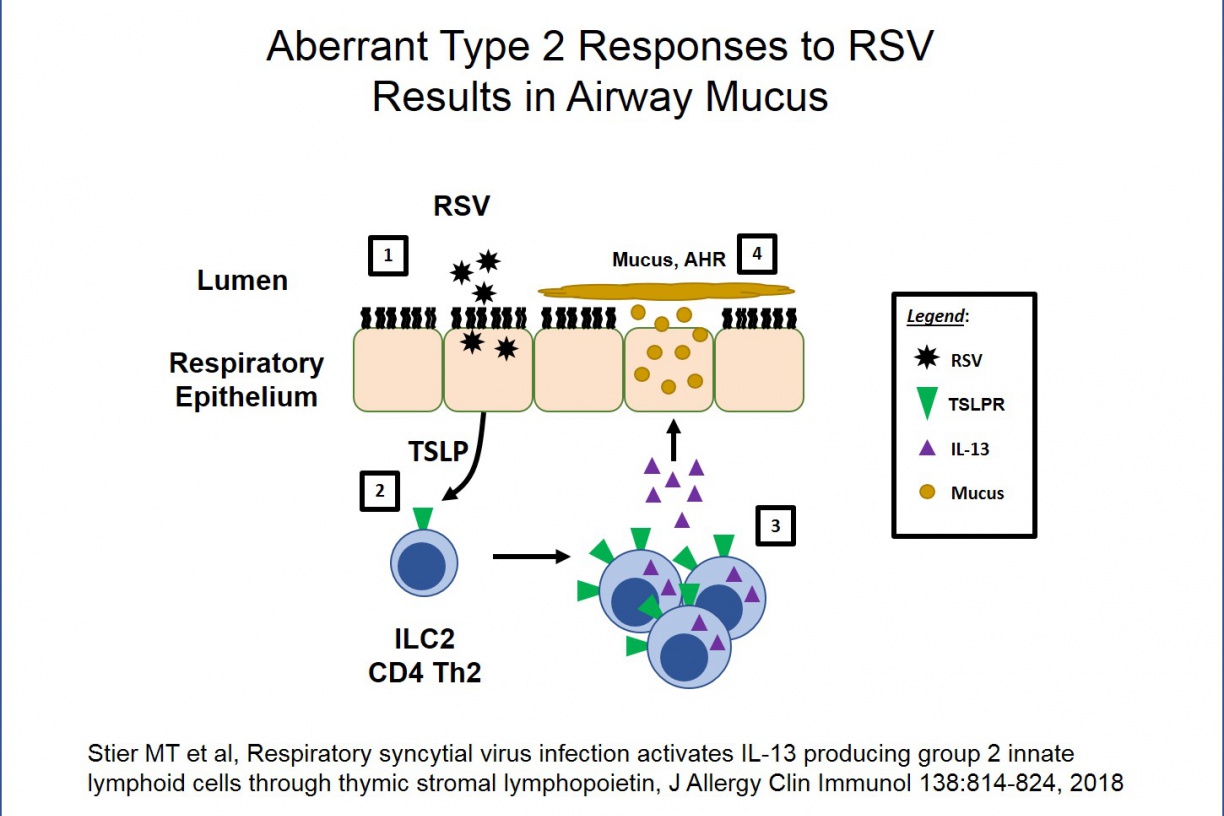 Aberrant Type 2 Responses to RSV