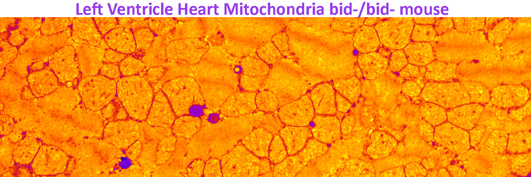 Left ventricle heart mitochondria graphic