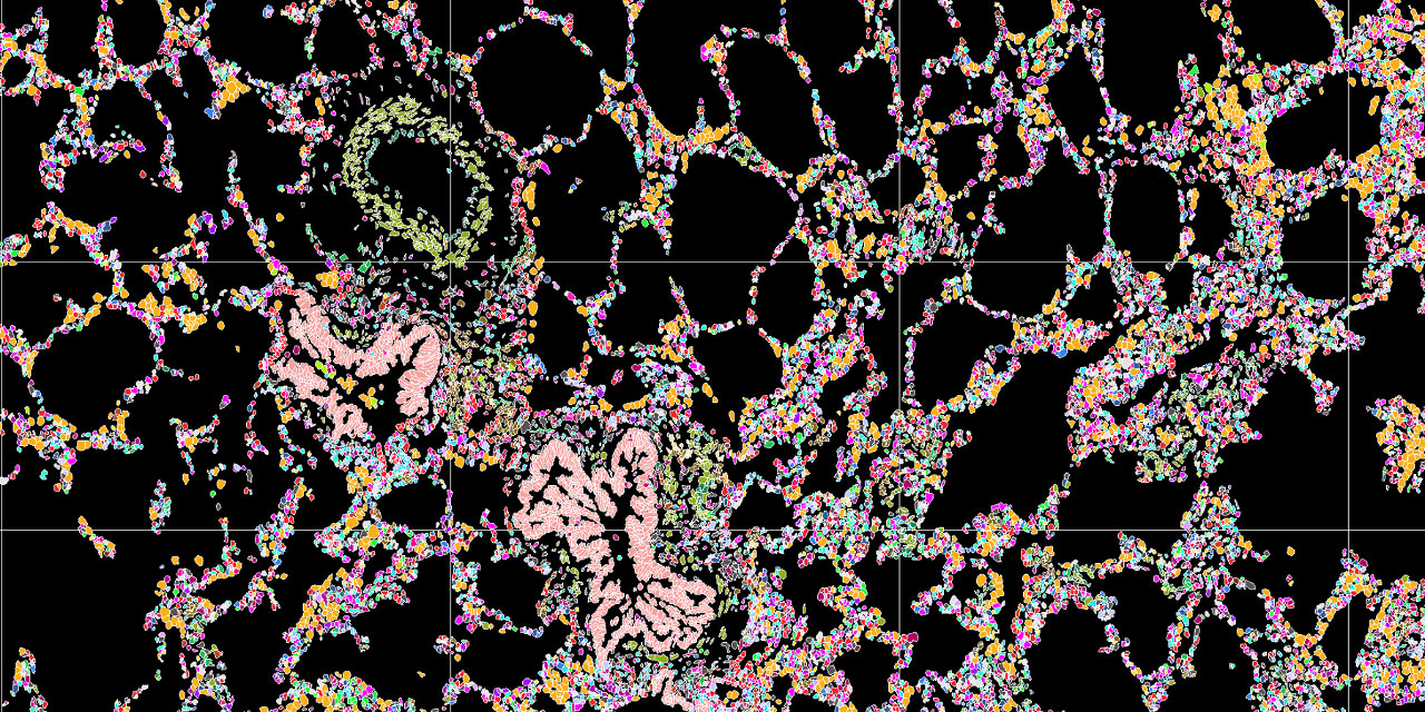 Imaging-based spatial transcriptomics 