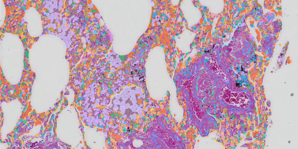 Imaging-based spatial transcriptomics 