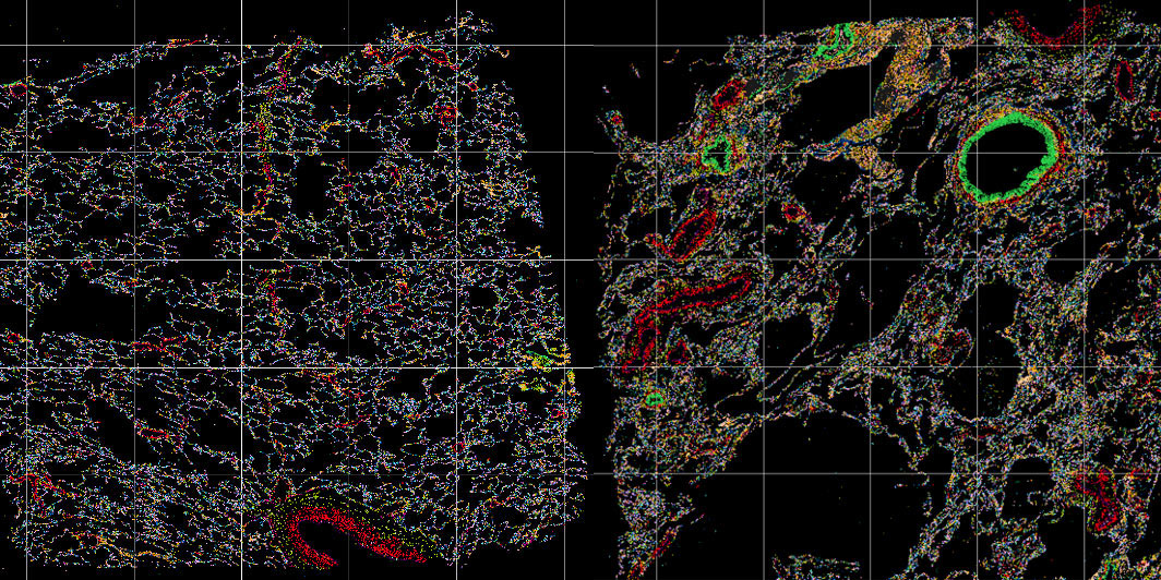 Imaging-based spatial transcriptomics 