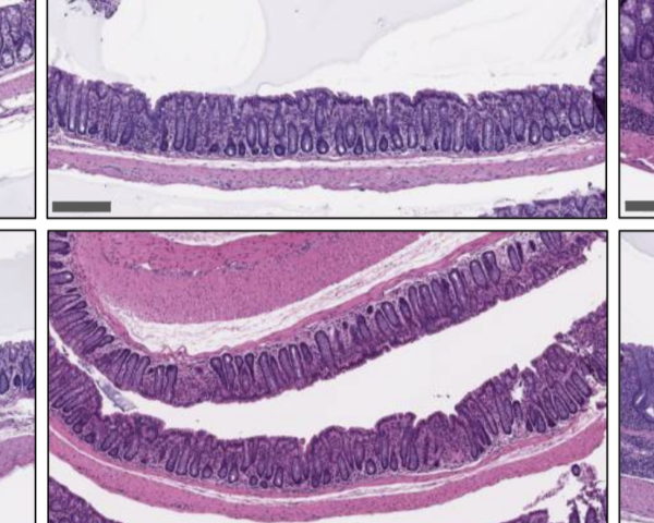 Purple and white scientific image of the intestines.