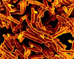 tuberculosis