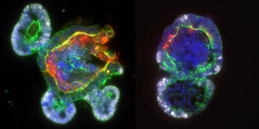 EBC research image